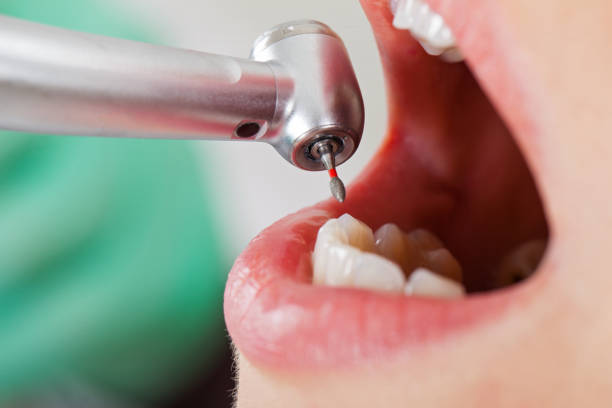 Best Dental Abscess Treatment in Chrisman, IL